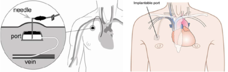 Patient information